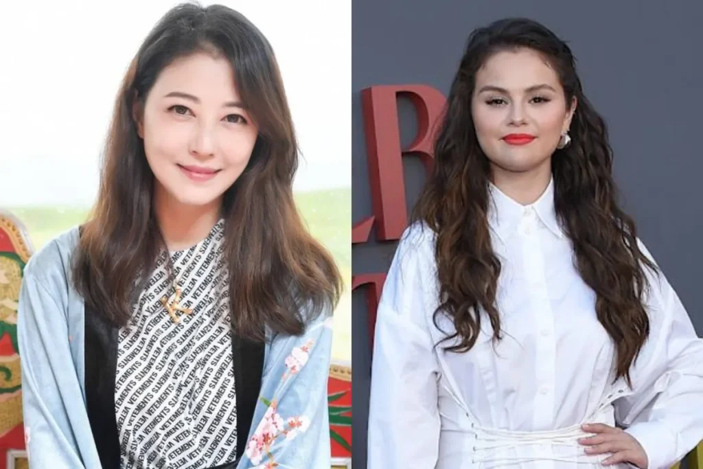 香港女星周海媚和美國小天后賽琳娜都曾受紅斑性狼瘡所苦