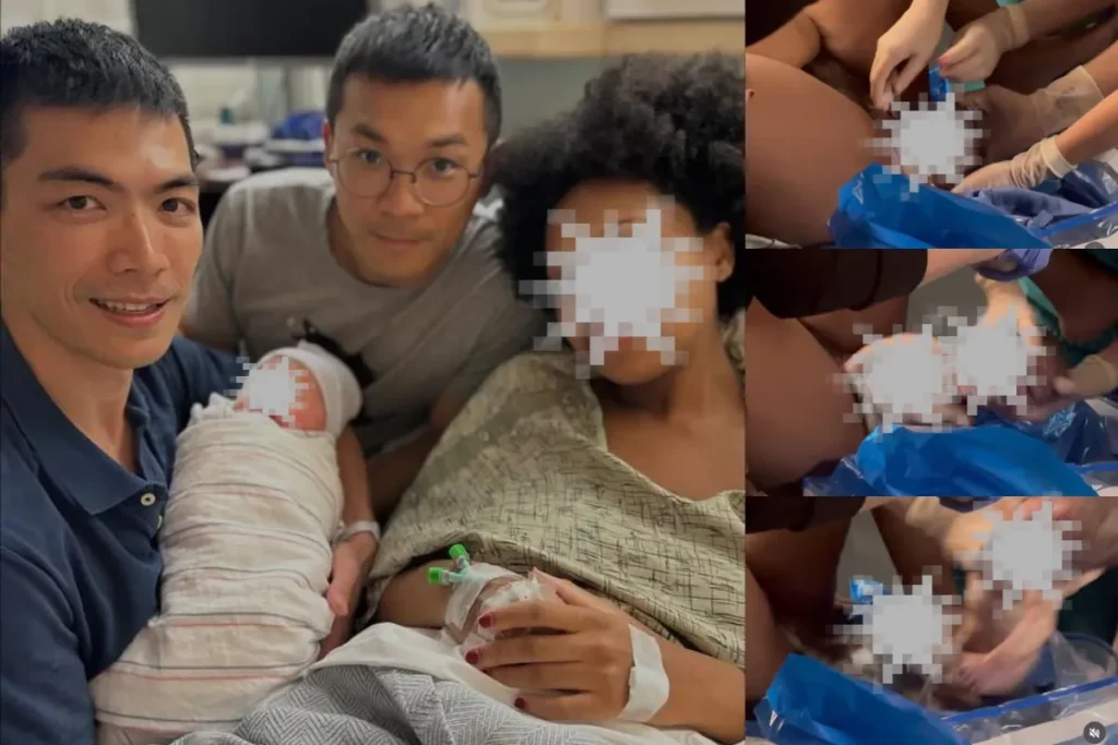 無獨有偶：慈濟醫師在 IG 上傳「孕母生產無碼影片」再掀第二波震盪