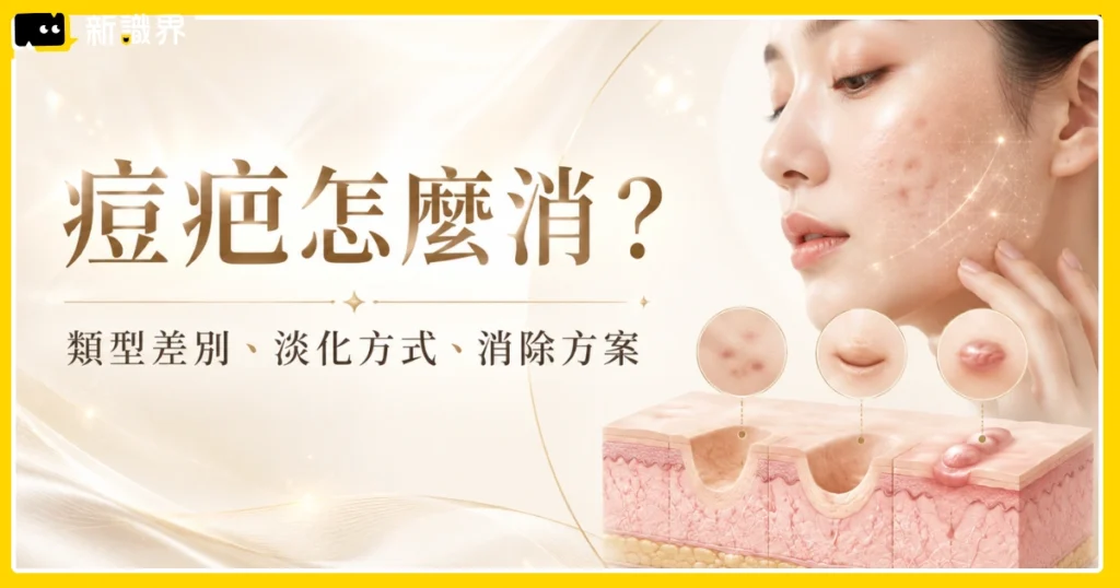 痘疤