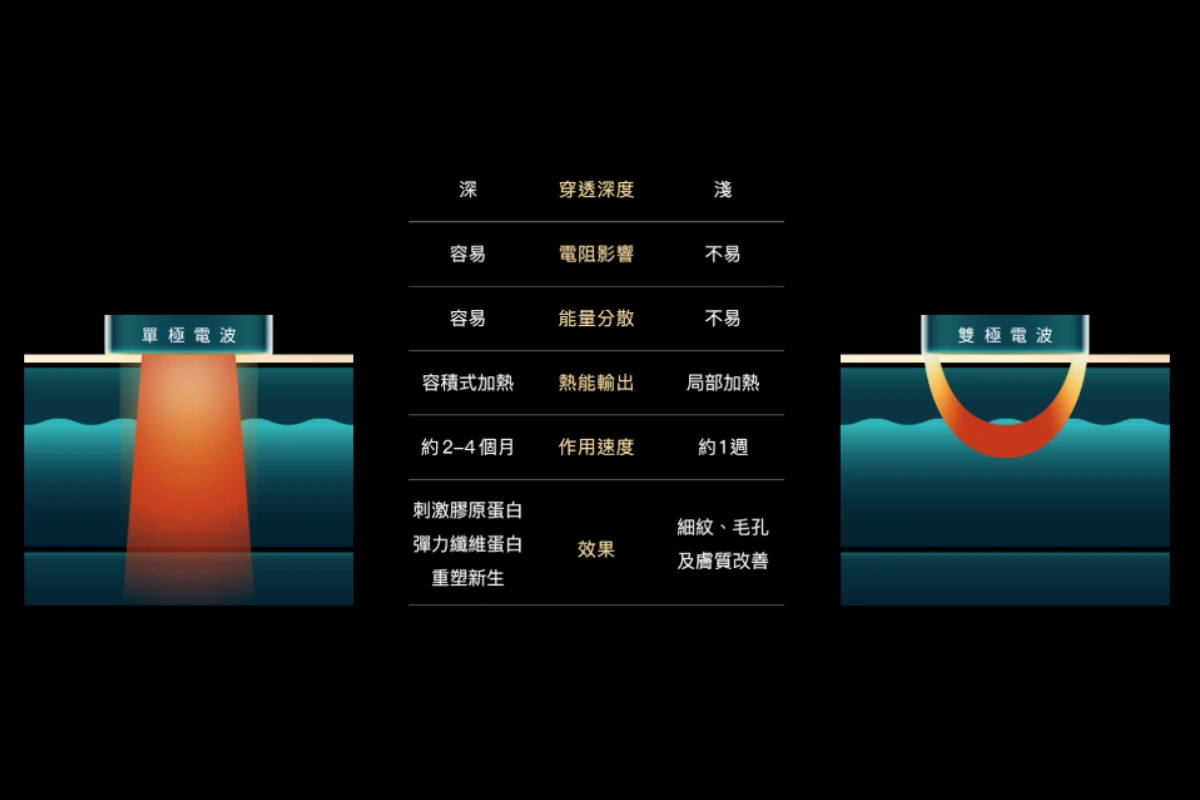 Density無雙電波鳳凰電波差別