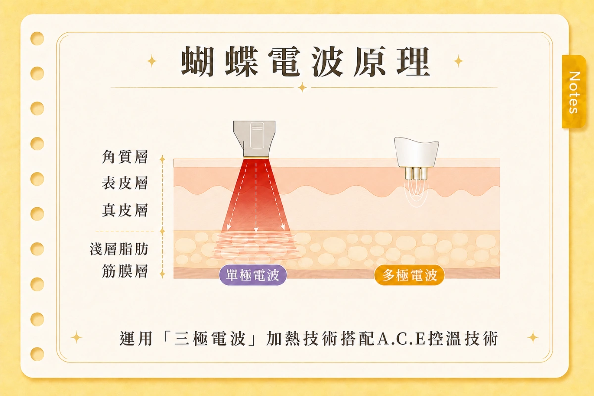 蝴蝶電波