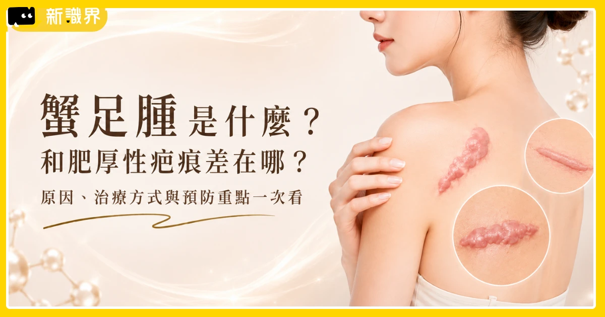 蟹足腫是什麼？和肥厚性疤痕差在哪？治療方式與預防重點