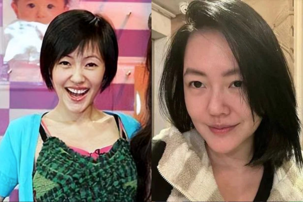 網友懷疑饅化臉藝人:小S