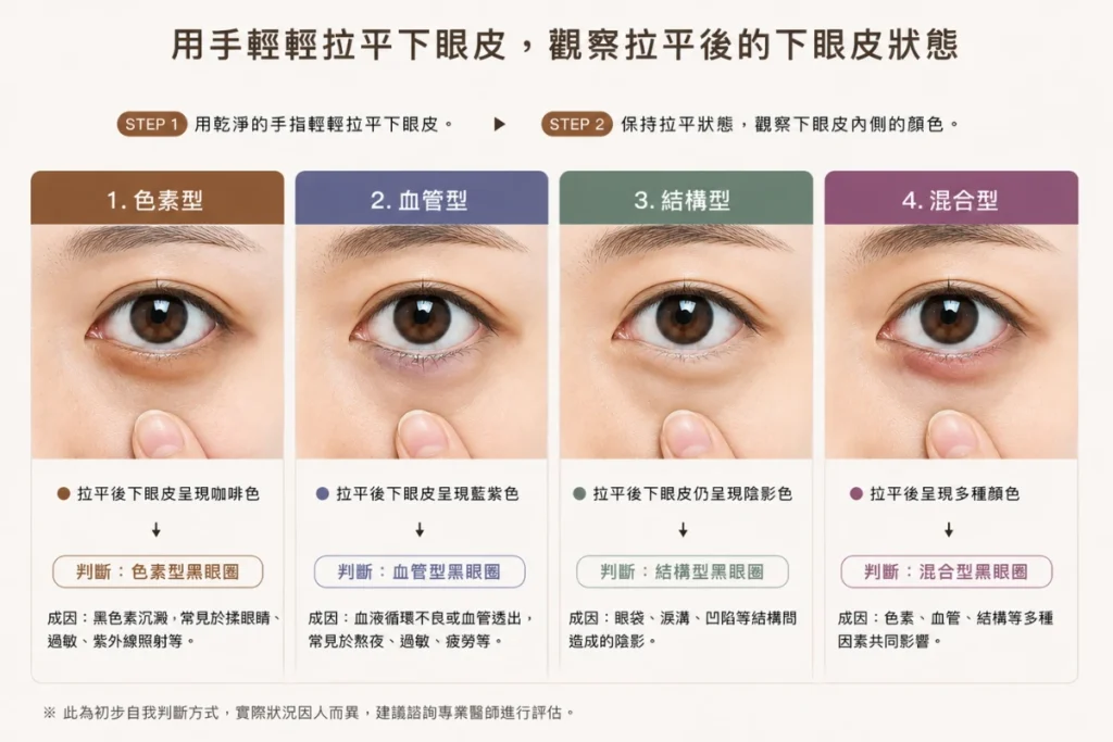 黑眼圈分辨方法