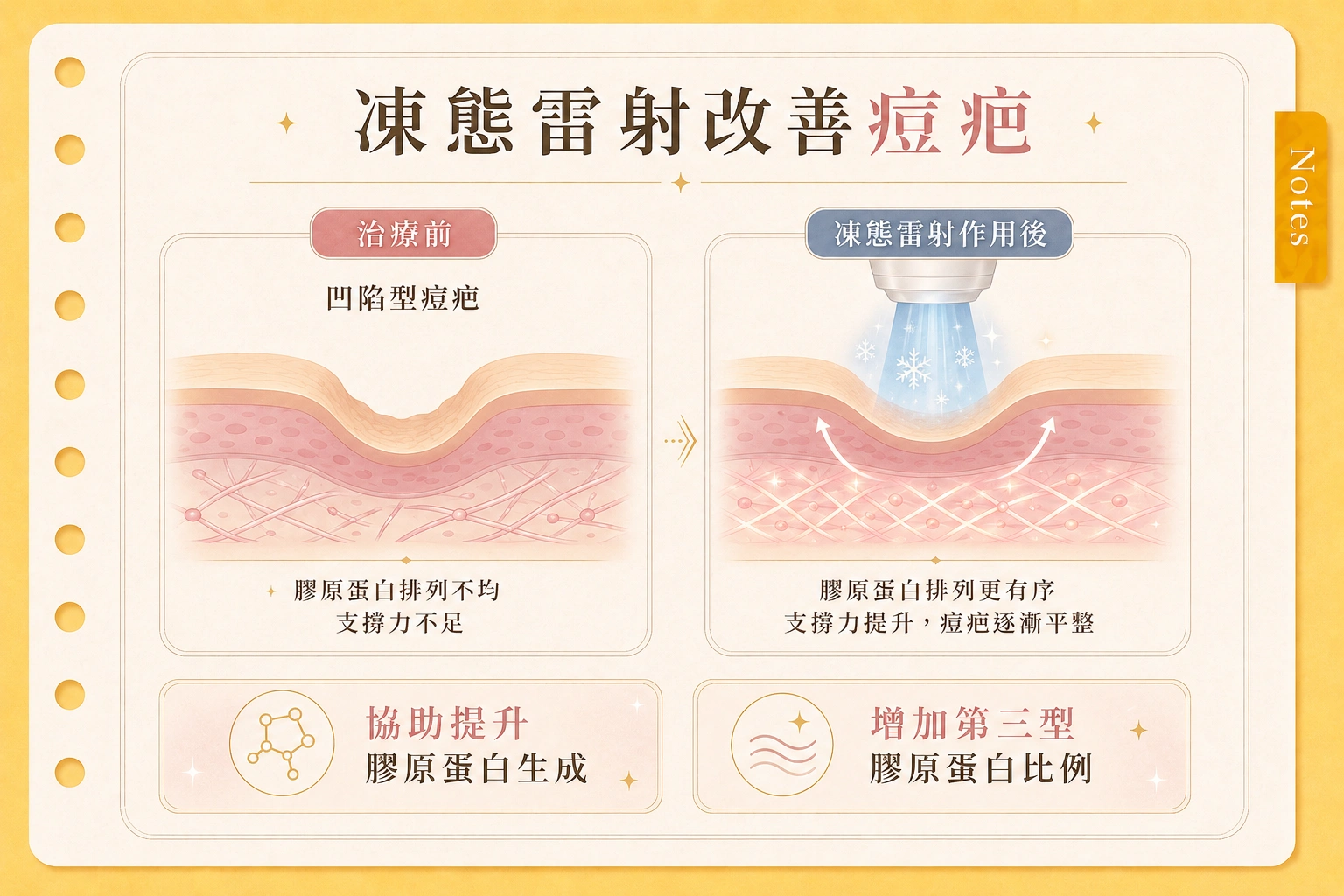凍態雷射RedTouch Pro