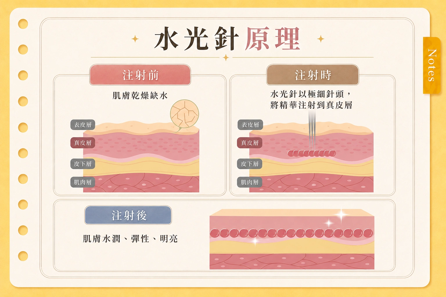 水光針
