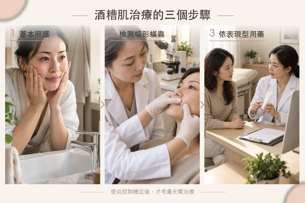 使用酒糟肌藥膏前,需先做好日常保養,並尋求專業醫療協助